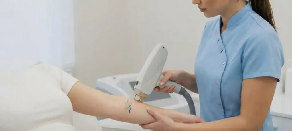Laser Tattoo Removal in Harrogate